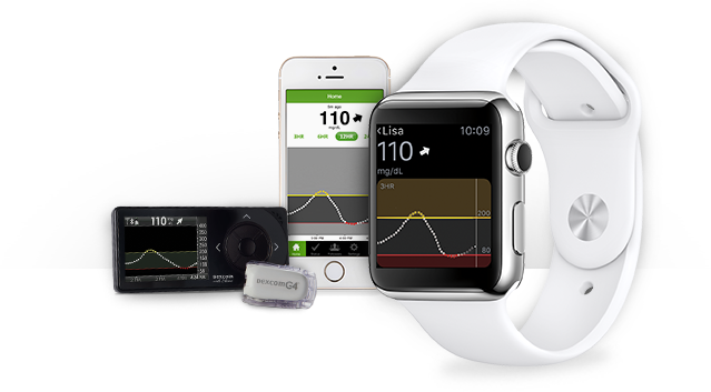 dexcom smartwatch