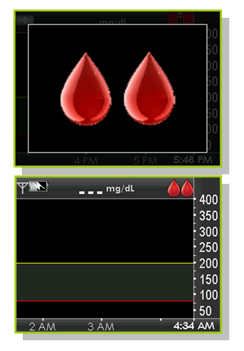 When and how often should I calibrate? | Dexcom