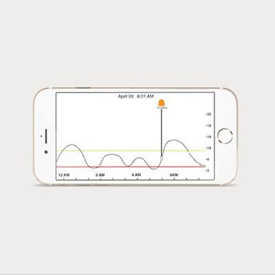 dexcom g5 mard