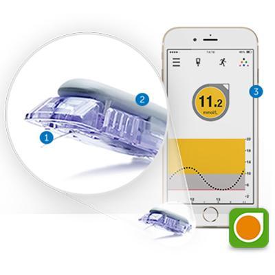 dexcom continuous monitoring system